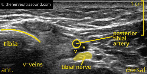 Standard sections tibial nerve – The Nerve Ultrasound